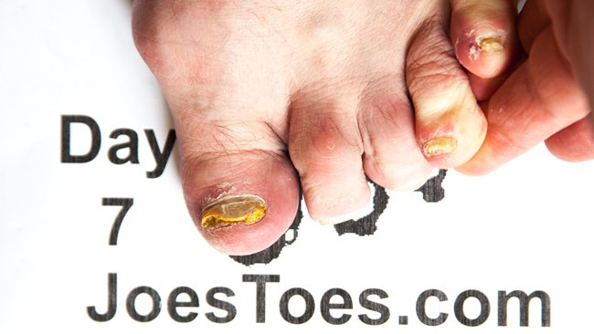 Day 7 left foot alt text