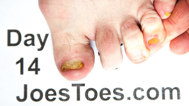 Day 14 left foot alt text